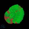 Scolymia Bleeding Apple